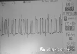 物联网黑客在bfrdmc中的技术手段与信息安全警示